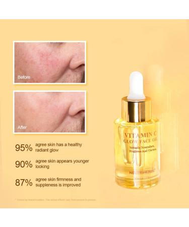 Neutriherbs Face Oil - Rosehip Jojoba & Grape Seed Oil with Vitamin C | Nourishing & Brightening Facial Oil for Dry Skin - 30ml - Buy Online on GoSupps.com