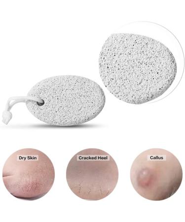 Pumice Stone 2Pcs Natural Lava Foot File for Callus Removal - Hand & Body Scrubber - Buy Online on GoSupps.com