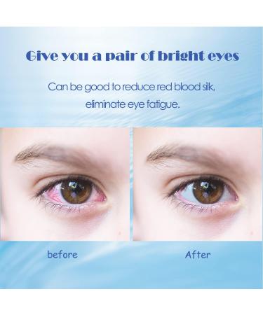 Buy XPOOS GCEA 4 Eyewash Cups - Durable Acrylic Fast International Shipping - Buy Online on GoSupps.com