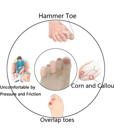 Gel Toe Caps - Breathable Silicone Protection for Blisters Ingrown Toenails & Pain Relief (10 Pack) - Buy Online on GoSupps.com