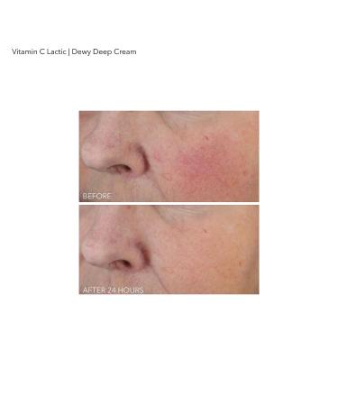 Dr Dennis Gross Vitamin C Lactic Dewy Deep Cream - Ultra-Rich Replenishing 2 oz - Buy Online on GoSupps.com