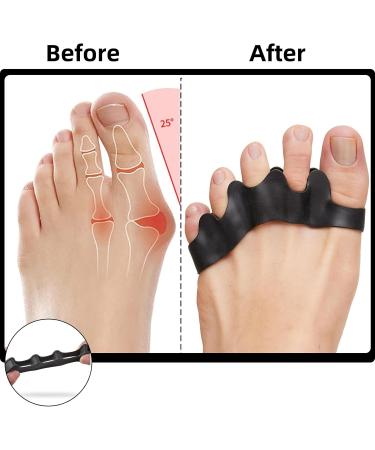 Buy Toe Separators for Men - Correct Toes Silicone Spacers for Yoga Running & Comfort - Buy Online on GoSupps.com