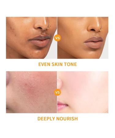 Baorder 6PCS Hydrating Skin Care Set with Vitamin C Face Care Kit Includes Serum Face Cream Eye Cream Toner Sunscreen Cleanser Face Care Set for Women Unique Gift - Buy Online on GoSupps.com