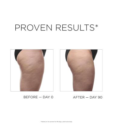 IDC Dermo Profil Cellulite Anti-Cellulite Body Sculpting Gel - Vegan Caffeine Treatment for Legs Stomach Arms & Thighs - 5 fl oz Body Firming & Toning Solution - Buy Online on GoSupps.com