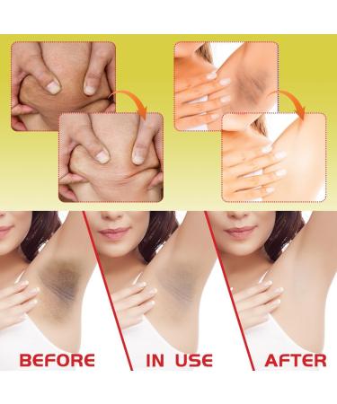 HASAIKA Turmeric Face Cream Turmeric Lightening Cream Dark Spot Correcting Cream Dark Spot Eliminator Evens Out Skin Tone Reduces Dry and Oily Skin Radiant Skin - Buy Online on GoSupps.com