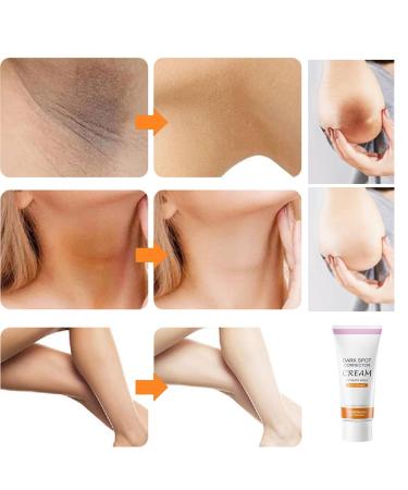 Dark Spot Corrector Cream - Remove Dark Spots on Face & Body | Collagen & Niacinamide | Instant Results | 2 oz - Buy Online on GoSupps.com