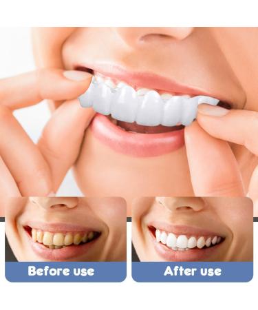 MIIKUU Temporary Cosmetic Veneers - 2 Pairs of Fake Teeth for Men & Women | Lightening Dentures & Prostheses Set - Buy Online on GoSupps.com