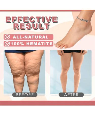 Magnetic Hematite Anti-Swelling Anklet for Women - Therapy Bracelet for Weight Loss - Circle Star Beach Lady Anklet Set - Buy Online on GoSupps.com