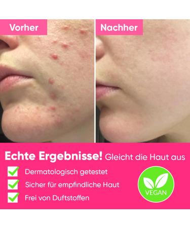 Ame Pure Peels So Good Fruit Acid Peeling Gel 120ml - AHA/BHA Gentle Exfoliator for Sensitive Skin - Reveal Bright Pure Skin - Buy Online on GoSupps.com