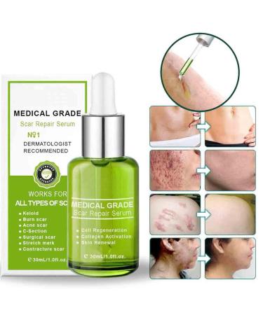 Goopgen Advanced Scar Repair Serum - Medical Grade Treatment for All Types of Scars (5PC) - Buy Online on GoSupps.com