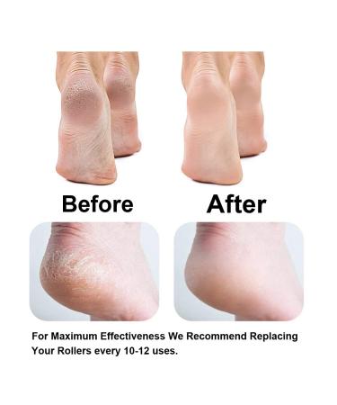 10 Pack Replacement Rollers for Finishing Touch Flawless Pedi Electric Tool File with 5 Black Coarse and 5 Gray Fine Rollers - Includes 2 Cleaning Brushes - Buy Online on GoSupps.com