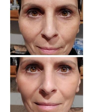 TR Skin Eye Serum - Plant Based Anti-Aging Treatment with Hyaluronic Acid | Reduces Dark Circles & Wrinkles | Organic Aloe Vera Skin Care - Buy Online on GoSupps.com