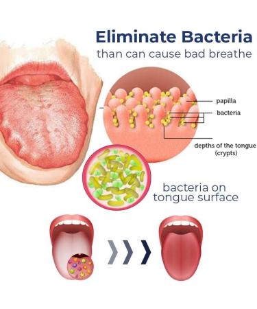 Canada White Hairy Tongue Removal Kit - Tongue Cleaner Gel and Scraper Set for Adults - Fresh Breath - 2PCS - Buy Online on GoSupps.com