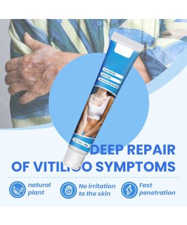 OIXYEY OIXEY 1 piece whitening cream natural plant extracts gently and effectively reduces white spots improves pigmentation suitable for all skin types 20 GB - Buy Online on GoSupps.com