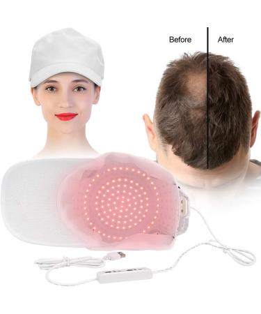 Laser Cap for Hair Regrowth - 108 Lamp Beads Hair Growth Hat for Men and Women - Oil Control Hair Loss Care Instrument - White Hat - Buy Online on GoSupps.com