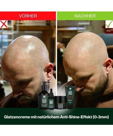 BETTER BE BOLD Basic Baldness Care Routine (0-3 mm) | Mattifying Baldness Cream (0-3 mm) + Nourishing Shampoo (0-6 mm) | Premium Baldness Care - Buy Online on GoSupps.com