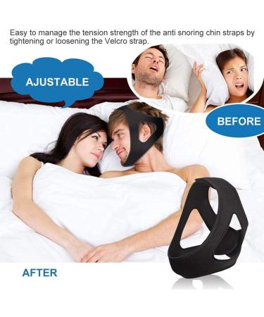 Adjustable 3D Anti Snoring Chin Strap - Stop Snoring Solution for Men, Women, Kids and Teenagers - Snore Stopper Device - 1 Pack - Buy Online on GoSupps.com