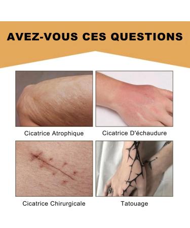 Autocollant Cicatrice Invisible Patch Peau Imperm able et Respirant pour Dissimulation Tatouage Correcteur Opaque Ultra Fin et Doux Ruban Camouflage Cicatrices et Marques Cutan es - Buy Online on GoSupps.com