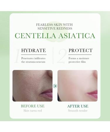 BIOAQUA Centella Asiatica Serum - Soothing Repair Oil Control & Anti-Acne Skin Care - 30ml - Buy Online on GoSupps.com