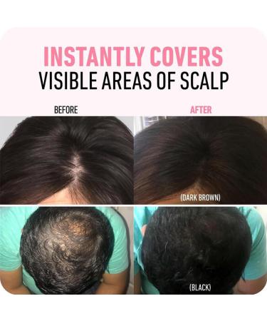 Hairline Powder for Gray Coverage | Root Cover Up Hair Color for Men & Women | Instant Hair Loss Concealer (Light Blonde - Buy Online on GoSupps.com