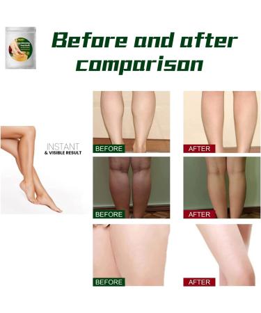 20PCS Lymphatic Drainage Ginger Foot Bath Bags - Slimming & Improve Sleep - Suitable for All - Buy Online on GoSupps.com