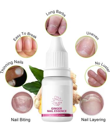 Nail Softener - Nail Strengthening Oil 10ml - Moisturizing Repair Care Nails Hands And Feet Sensitive Skin Men Women Daily Use Night Travel Manicure Pedicure - Buy Online on GoSupps.com