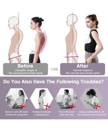 Acwoo Posture Correction Trainer for Men & Women - Adjustable Back Support Belt with Breathable Shoulder Straps (XL) | Improve Posture & Relieve Neck & Shoulder Pain - Buy Online on GoSupps.com