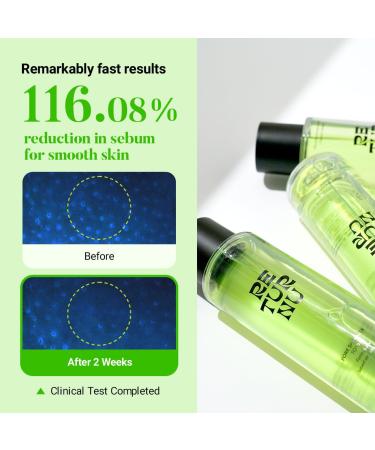 Poreshooter Pore Toner - Korean Oily Skin Minimizer with BHA & Hyaluronic Acid | Vegan Cruelty-Free Hydrating Calming Control - Buy Online on GoSupps.com
