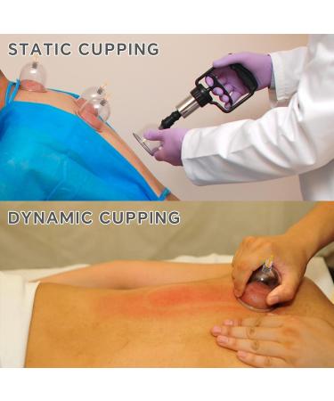 Cupping Set 24 Cups Hijama Therapy with Vacuum Suction Pump for Back Pain Relief | Chinese Acupoint Physical Cupping Massage | Cellulite Treatment | 24 Count - Buy Online on GoSupps.com