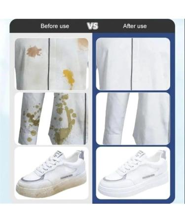 3 packs Stain Removal Wet Wipes Instant Mini Stain Remover Wipes Emergency Stain Rescue Stain Remover For Clothes Fabric Carpet (Color : Blue) - Buy Online on GoSupps.com