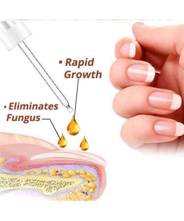 7 Days Nail Growth and Strengthening Serum Natural Nail Growth And Strength Serum Nail Repair Solution for Damaged and Discolored Nails Promotes Rapid Growth & Avoids Flaking (1pcs) - Buy Online on GoSupps.com