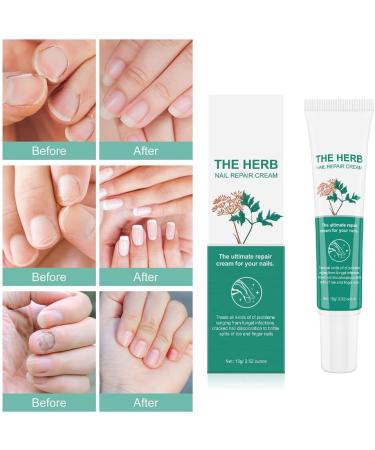 Nail Repair Cream Nail Fungal Treatment Nail Fungal Treatment Fungal Nail Cure Nail Fungus Treatment For Toenail Fungal Nail Treatment Nail Repair - Buy Online on GoSupps.com