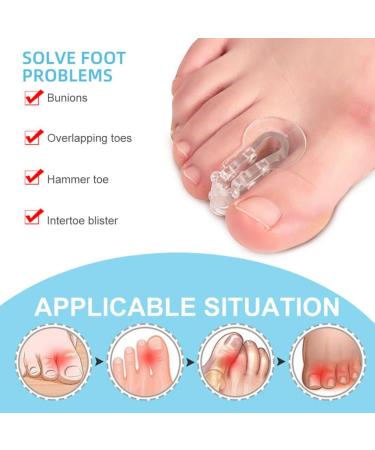 Healifty 3 Pairs Hallux Separator Spreader Correctors - Small Clear Women Spacer Protector Relief Tools - Buy Online on GoSupps.com