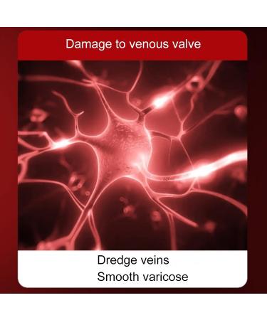 Varicose Veins & Muscle Relief Cream - Professional Treatment for Legs, Phlebitis Relief - Buy Online on GoSupps.com