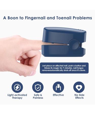 Rechargeable Nail Fungus Laser: Home Use LED Light Treatment - SUNCKY - Buy Online on GoSupps.com