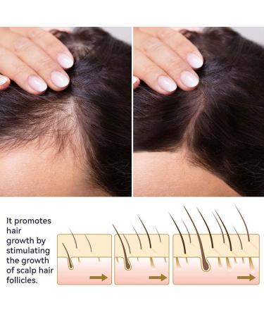 Blusoms Hairgrowth Formula Serum Spray - Set of 2 | Promotes Healthy Hair Growth - Buy Online on GoSupps.com