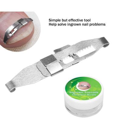 Ingrown Toenail Treatment Kit for Pain Relief - Paronychia Corrector Tool Set for Salon and Home Use - Buy Online on GoSupps.com