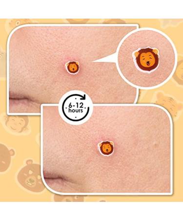 Animal Shape Pimple Patches - 120 Hydrocolloid Spot Dots for Breakouts and Blemishes - Buy Online on GoSupps.com