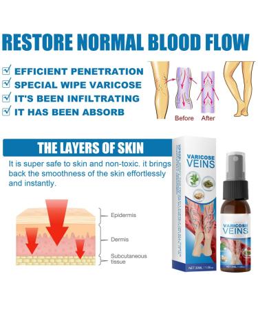 Varicose Veins Cream - Lichengtai Miracle Spray for Varicose & Spider Veins Relief - 3 Pack (20g) - Fast Muscle Soreness Relief - Buy Online on GoSupps.com