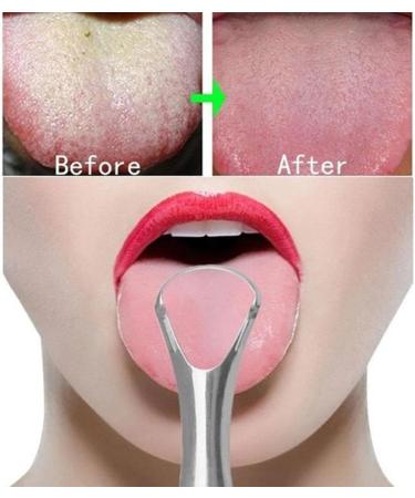Stainless Steel Tongue Scraper for Adults - Surgical Grade Oral Care Tool to Eliminate Bad Breath | 1pc Hygienic Solution - Buy Online on GoSupps.com
