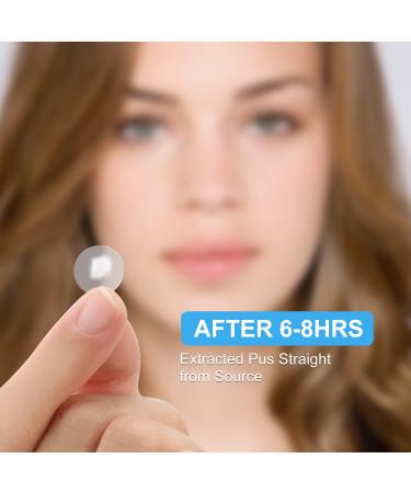 AVJONE Day and Night Hydrocolloid Acne Pimple Patch - 108+36 Vegan-Friendly Spot Stickers for Face and Skin - Buy Online on GoSupps.com
