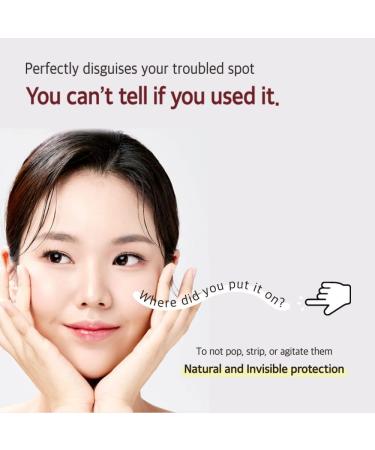 Mixsoon Spot Clean Care Patch - 84 Acne Pimple Healing Patches for Troubled Skin | Seamless Coverage & Fast Results - Buy Online on GoSupps.com