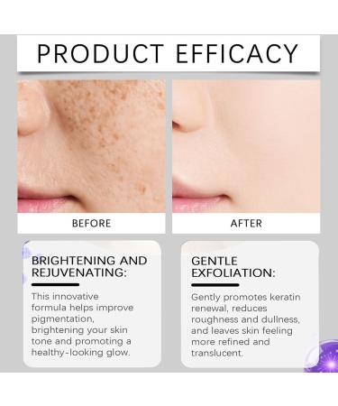 Moisturizing Serum - Fades Dark Spots And Acne Marks Evens Skin Tone Reveals A Radiant Glow Gentle Formula(2pcs) - Buy Online on GoSupps.com