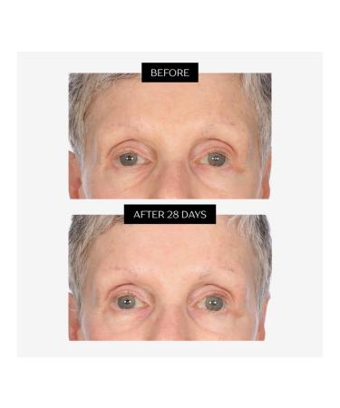 Perlier Black Rice Eye Serum Anti-Aging Moisturizing Gel Fine Line Reducer With Organic Black Rice Extract Light Texture Formula 2-Pack1.5 fl oz each - Buy Online on GoSupps.com