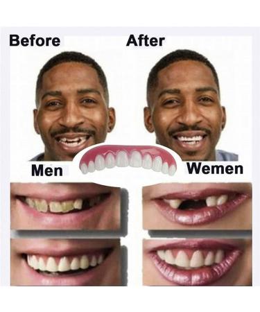 Instant Veneers & Provisional Dentures | Mxrfactory Snap-On Smile for Men & Women | Brightening Upper & Lower Teeth Comfort Fit - 3 Pairs - Buy Online on GoSupps.com