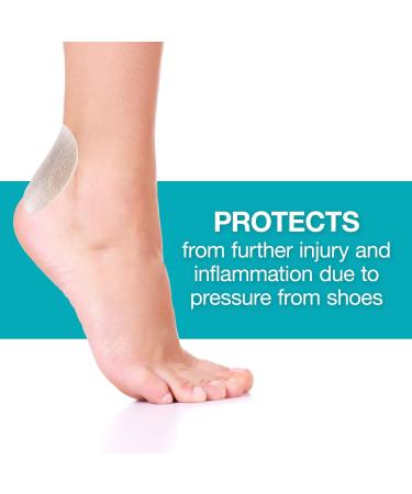 Steins Moleskin Pre-Cut Oval Foot Pads - Heel & Toe Blister Protectors - 100 Count - Buy Online on GoSupps.com