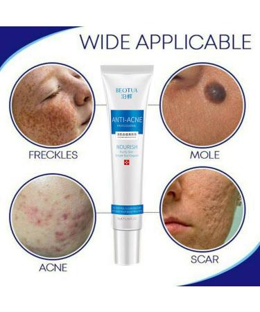 Removal Mark Pimple Pro Blemish Scar Spots Ointment for Glass Skin - White One Size - Buy Online on GoSupps.com