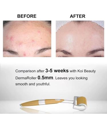 KOI BEAUTY Derma Roller 0.5mm- 192 Real Individual Needles Titanium Microneedling Roller for Hair Beard Roller for Beard Growth Dermaroller for Face Body Scalp for Women Men At Home 192 Real Individual Needle 0.5mm - Buy Online on GoSupps.com