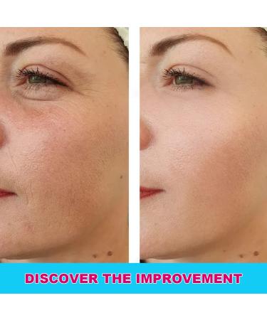 Ceessting Vitamin C Serum for Face - Anti-Aging Serum with Hyaluronic Acid & Vitamin E - 1 oz - Buy Online on GoSupps.com