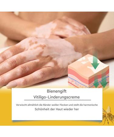 Cr me pour les pieds - Cr me de soin pour les pieds - Nourrissante et claircissante aux extraits de - Soin hydratant pour peaux s ches et sensibles - Corps et mains - Buy Online on GoSupps.com